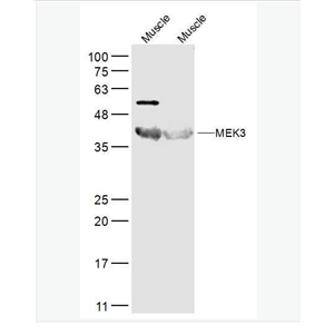 Anti-MEK3  antibody-丝裂原活化蛋白激酶MKK3抗体