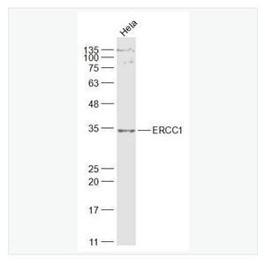 Anti-ERCC1antibody-DNA切除修复蛋白1抗体
