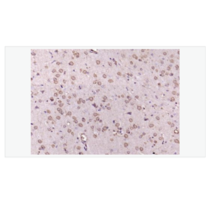 Anti-phospho-Erk1 antibody-磷酸化丝裂原活化蛋白激酶1抗体,phospho-Erk1 (Thr202 + Tyr204)