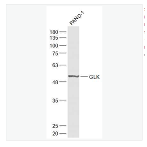Anti-GLK antibody-葡萄糖激酶抗体,GLK