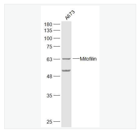 Anti-Mitofilin antibody-線粒體內(nèi)膜蛋白抗體,Mitofilin