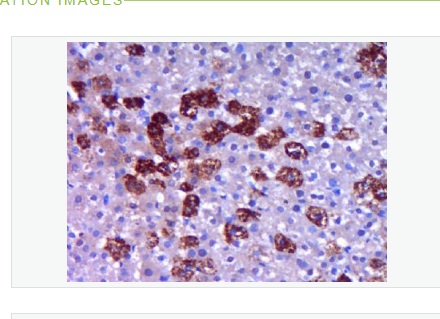 Anti-MAP1A  antibody-微管相關(guān)蛋白1A抗體,MAP1A