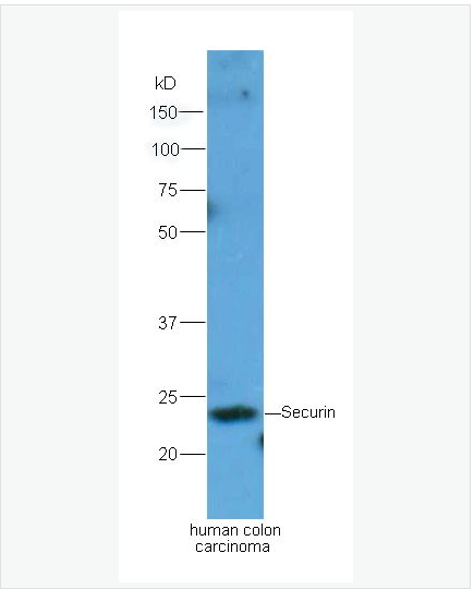 Anti-Securin antibody-垂体肿瘤转化基因抗体,Securin