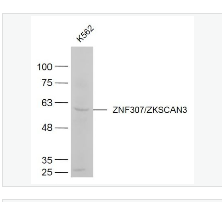 Anti-ZNF307/ZKSCAN3 antibody-锌指蛋白307抗体,ZNF307/ZKSCAN3