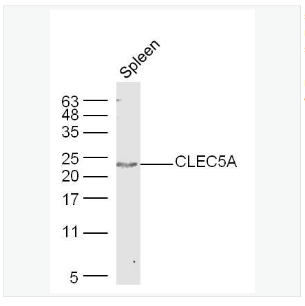 Anti-CLEC5A  antibody-C型凝集素结构域家族5成员A抗体,CLEC5A