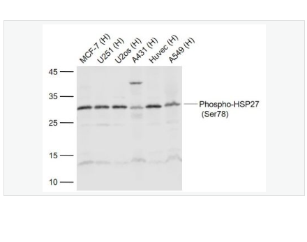 Anti-Phospho-HSP27  antibody-磷酸化热休克蛋白27抗体,Phospho-HSP27 (Ser78)