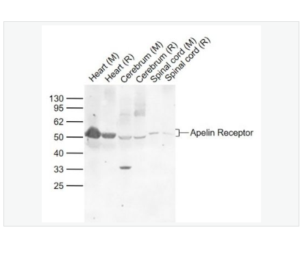 Anti-Apelin Receptor  antibody-血管紧张素II受体样蛋白1抗体,Apelin Receptor