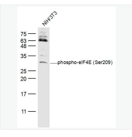 Anti-phospho-eIF4E  antibody-磷酸化真核翻譯起始因子4E抗體,phospho-eIF4E (Ser209)