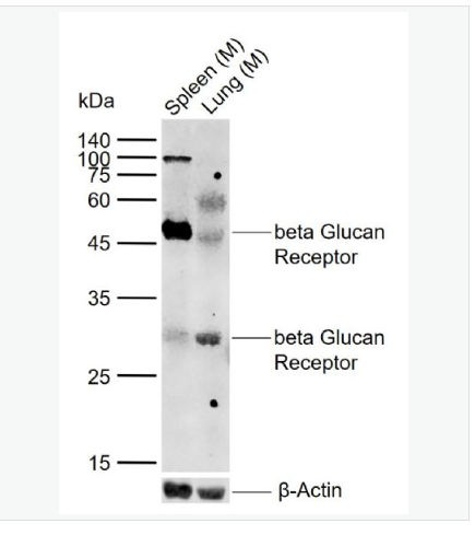 Anti-CLEC7A  antibody-β葡聚糖受体抗体,CLEC7A