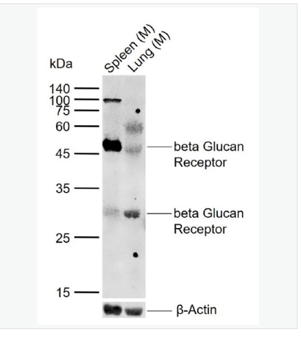 Anti-CLEC7A  antibody-β葡聚糖受體抗體,CLEC7A