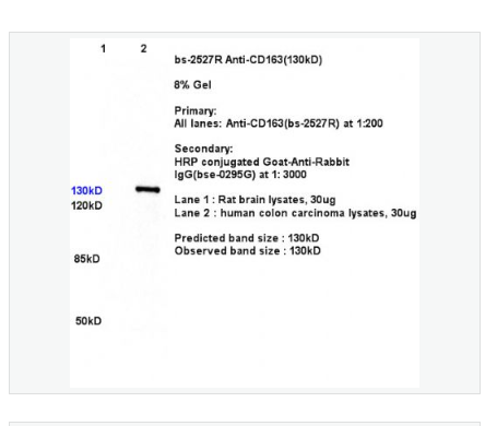 Anti-CD163 antibody-CD163抗體,CD163