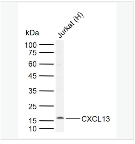 Anti-CXCL13 antibody-B-淋巴细胞趋化因子抗体,CXCL13