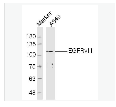 Anti-EGFRvIII antibody-B-表皮生长因子受体III型突变体抗体,EGFRvIII