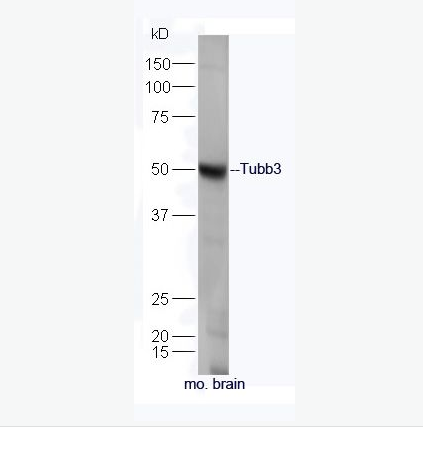 Anti-Tubb3 antibody-微管蛋白β3抗体,Tubb3