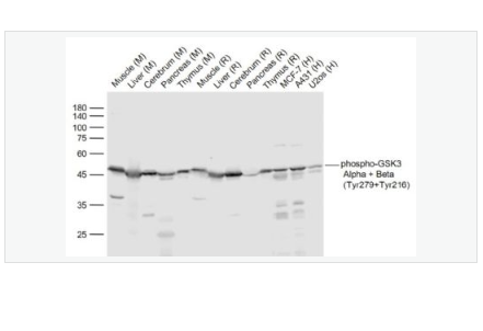 Anti-phospho-GSK3 Alpha + Beta antibody-磷酸化糖原合酶激酶3α/β抗體,phospho-GSK3 Alpha + Beta (Tyr279+Tyr216)