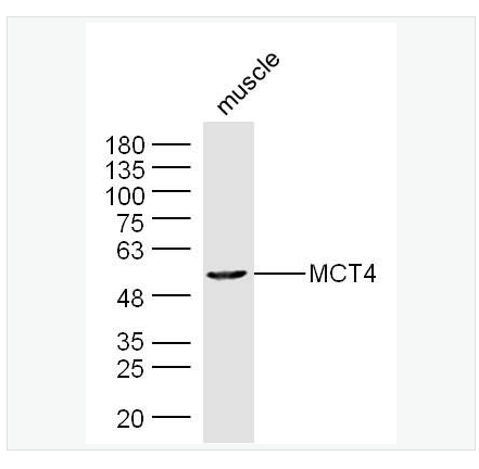 Anti-MCT4/SLC16A3 antibody-单羧酸转运蛋4抗体,MCT4/SLC16A3