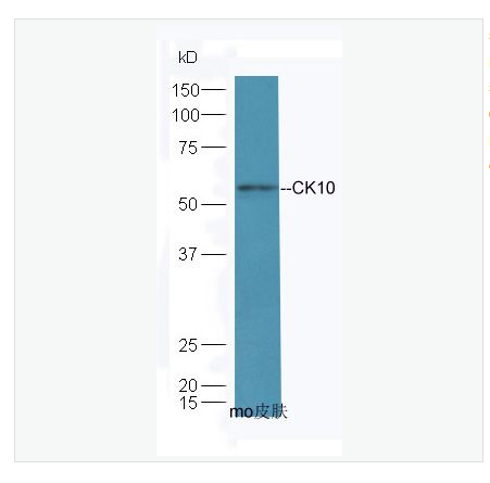 Anti-CK10 antibody-细胞角蛋白10抗体,CK10