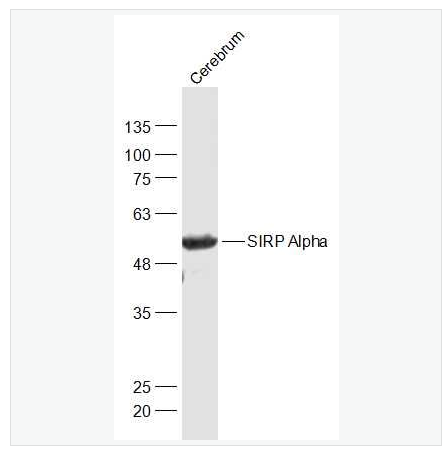 Anti-SIRP Alpha antibody-信號(hào)調(diào)節(jié)蛋白α抗體,SIRP Alpha