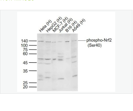 Anti-phospho-Nrf2  antibody-磷酸化核因子2相关因子2(Ser40)抗体,phospho-Nrf2 (Ser40)