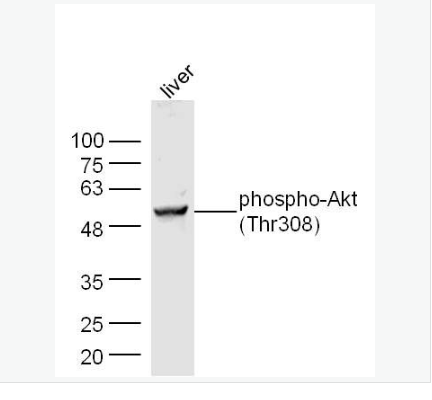 Anti-phospho-Akt antibody-磷酸化蛋白激酶B抗體,phospho-Akt (Thr308)