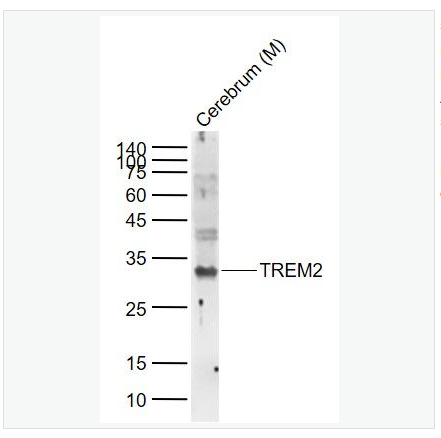 Anti-TREM2  antibody-髓系細胞觸發(fā)受體2抗體,TREM2