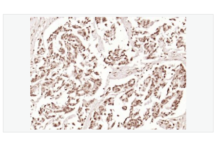 Anti-Phospho-Beta Catenin antibody-磷酸化β 连环素蛋白抗体,Phospho-Beta Catenin (Thr41 + Ser45)