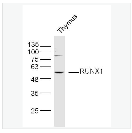 Anti-RUNX1 antibody-急性髓细胞白血病1蛋白抗体,RUNX1