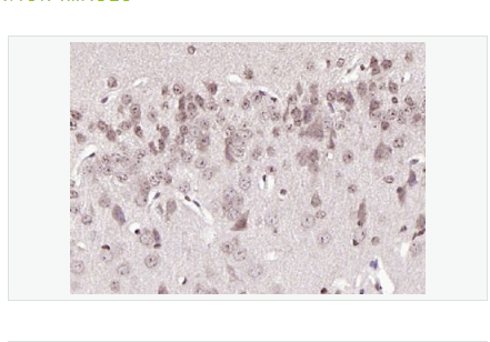 Anti-phospho-BRAF  antibody-磷酸化B-Raf抗體,phospho-BRAF (Ser365)