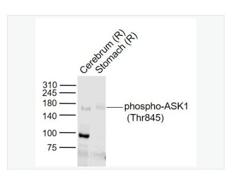 Anti-phospho-ASK1  antibody-磷酸化细胞凋亡信号调节激酶1抗体,phospho-ASK1 (Thr845)