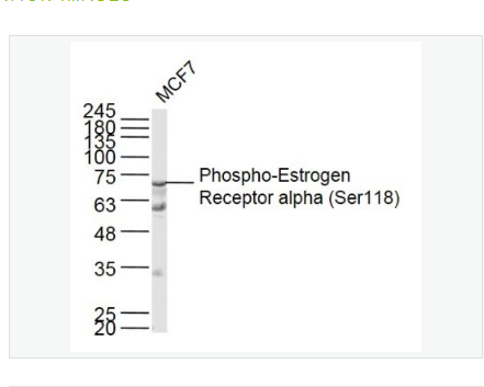 Anti-Phospho-Estrogen Receptor alpha  antibody-磷酸化雌激素受体α抗体,Phospho-Estrogen Receptor alpha (Ser118)