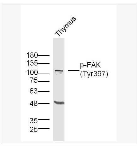 Anti-Phospho-FAK  antibody-磷酸化粘着斑激酶抗体,Phospho-FAK (Tyr397)