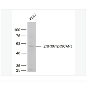 Anti-ZNF307/ZKSCAN3 antibody-锌指蛋白307抗体
