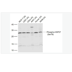 Anti-Phospho-HSP27  antibody-磷酸化热休克蛋白27抗体