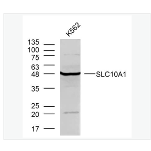 Anti-SLC10A1 antibody-钠离子/牛磺胆酸共转运蛋白抗体