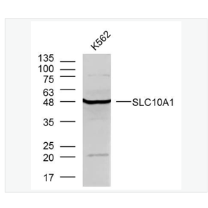 Anti-SLC10A1 antibody-钠离子/牛磺胆酸共转运蛋白抗体,SLC10A1