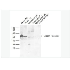 Anti-Apelin Receptor  antibody-血管緊張素II受體樣蛋白1抗體