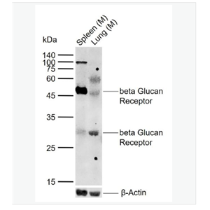 Anti-CLEC7A  antibody-β葡聚糖受体抗体,CLEC7A