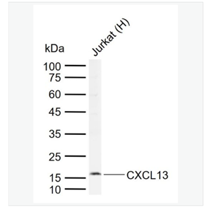 Anti-CXCL13 antibody-B-淋巴细胞趋化因子抗体