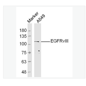 Anti-EGFRvIII antibody-B-表皮生长因子受体III型突变体抗体