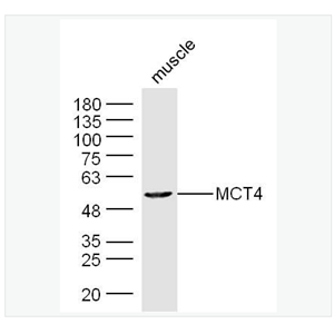 Anti-MCT4/SLC16A3 antibody-單羧酸轉(zhuǎn)運(yùn)蛋4抗體,MCT4/SLC16A3