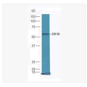 Anti-CK10 antibody-细胞角蛋白10抗体,CK10