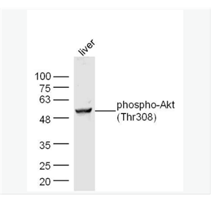 Anti-phospho-Akt antibody-磷酸化蛋白激酶B抗体