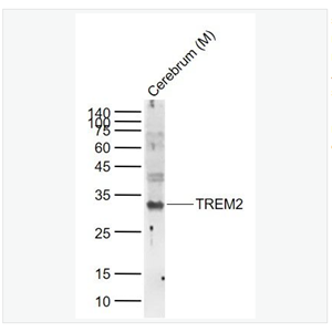 Anti-TREM2  antibody-髓系细胞触发受体2抗体