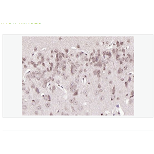 Anti-phospho-BRAF  antibody-磷酸化B-Raf抗体,phospho-BRAF (Ser365)