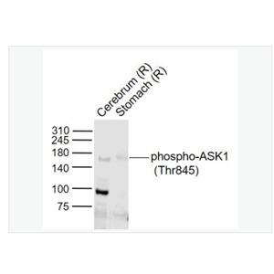 Anti-phospho-ASK1  antibody-磷酸化细胞凋亡信号调节激酶1抗体