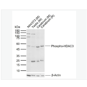 Anti-Phospho-HDAC3   antibody-磷酸化组蛋白去乙酰化酶3抗体