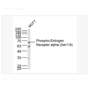 Anti-Phospho-Estrogen Receptor alpha  antibody-磷酸化雌激素受体α抗体