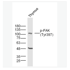 Anti-Phospho-FAK  antibody-磷酸化粘着斑激酶抗体