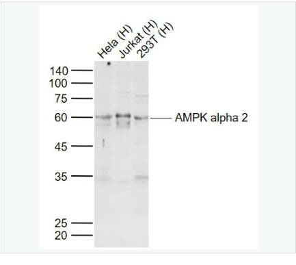 Anti-AMPK alpha 2  antibody-腺苷单磷酸活化蛋白激酶α2抗体,AMPK alpha 2
