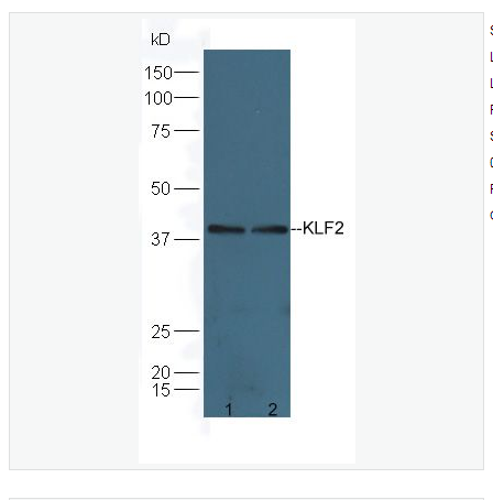 Anti-KLF2 antibody-肺Kruppel样因子抗体,KLF2